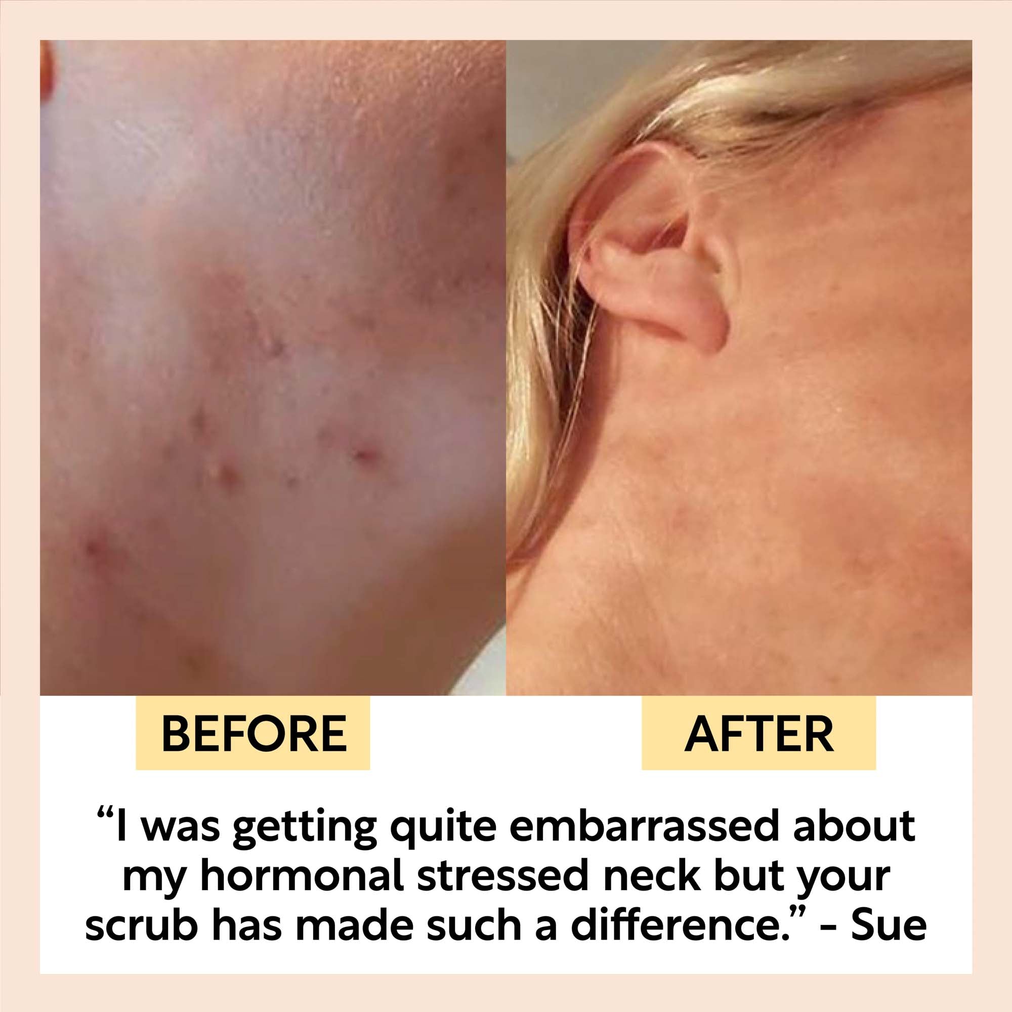 Face Scrub with Coffee + Rosehip Oil